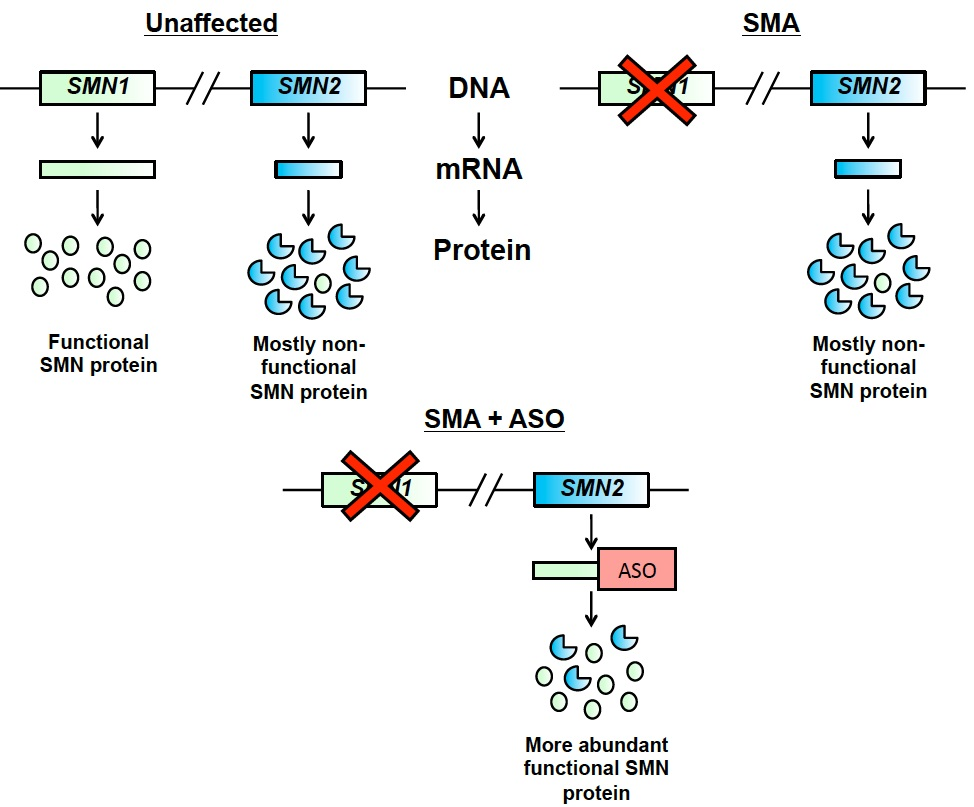 Diagram showing how antisense oligonucleotides target SMN2 mRNA to increase exon 7 inclusion, and therefore increase the amount of functional SMN protein produced by the SMN2 gene.