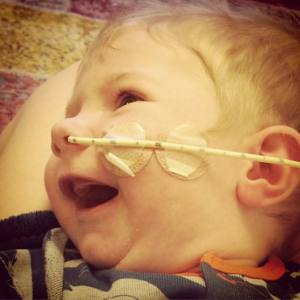 Image shows a little boy lying on his side and smiling. He has a nasal tube.