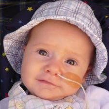 Image shows a baby boy looking at the camera. He is wearing a cheque patterned hat and top, and has a nasal tube.