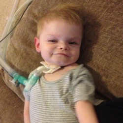 Image shows a little boy with a tracheostomy who has SMARD1.