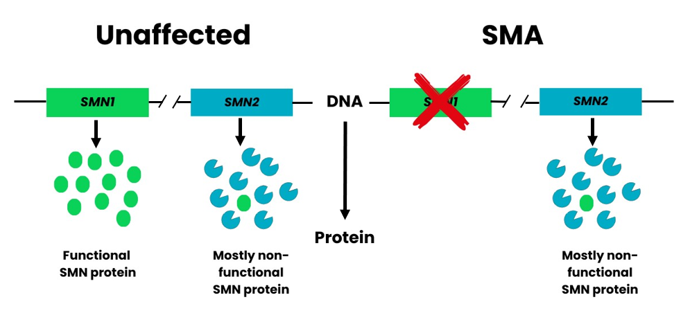 Diagram showing how the SMN2 gene works